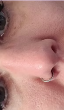 Antes - Imagen antes