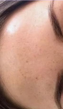 Después - Imagen después