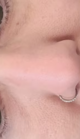 Después - Imagen después