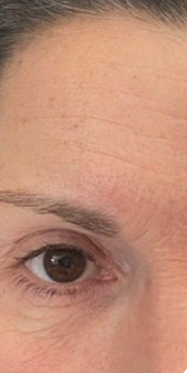 Después - Imagen después